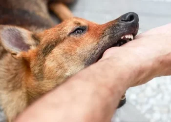 Diserang Kawanan Anjing, Siswa SD di Campaka Alami Luka Berat