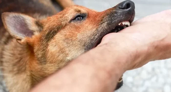 Diserang Kawanan Anjing, Siswa SD di Campaka Alami Luka Berat