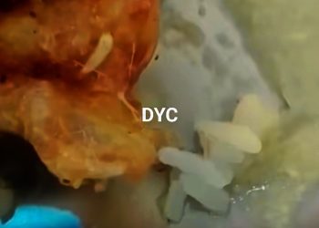 Menu Telur Ceplok di SDN Cisarandi Berbilatung