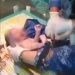 Bayi Didalam Karung di Cilaku Ditemukan Warga, Polisi Selidiki!